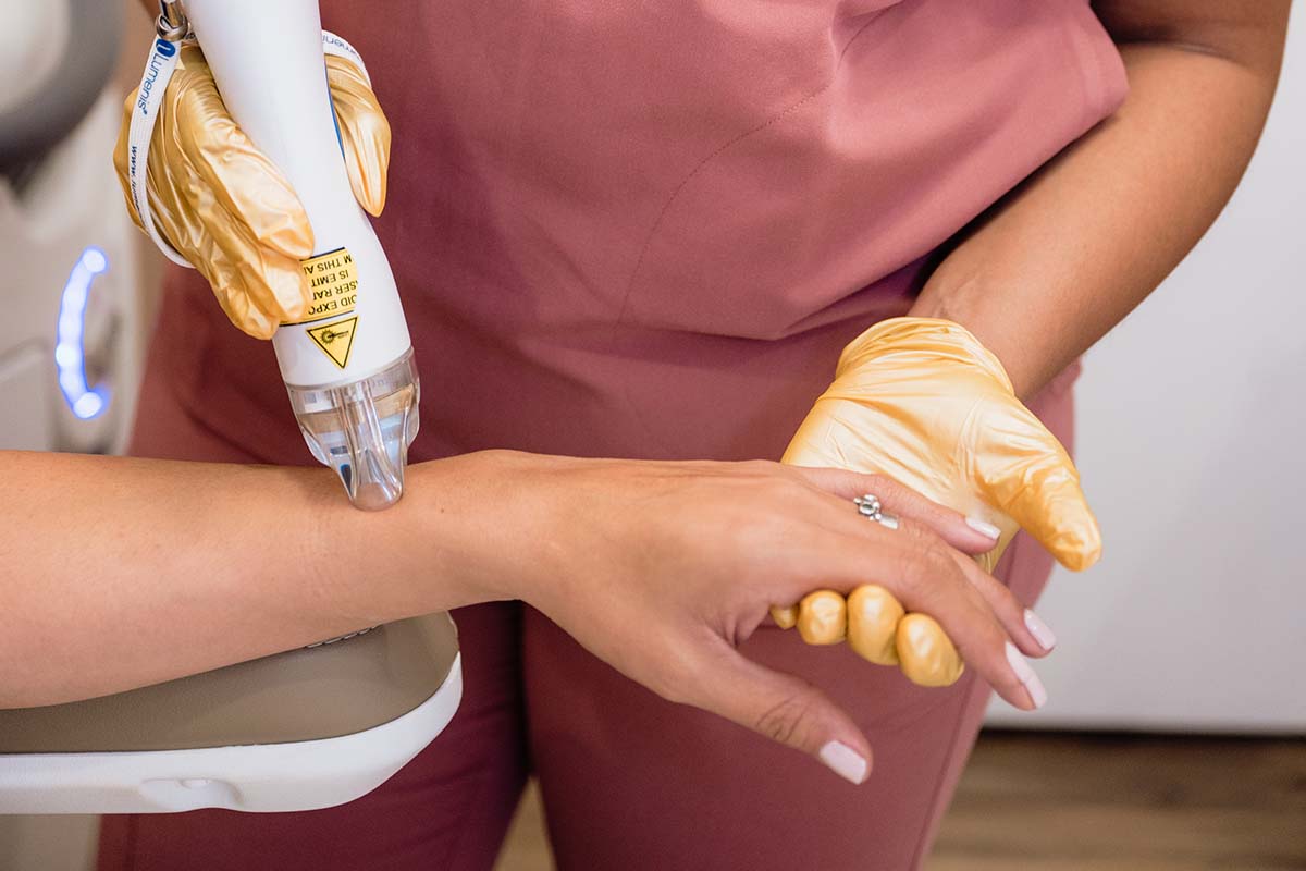 Laser Hair Removal in Clermont, FL | Reign Medical Aesthetics