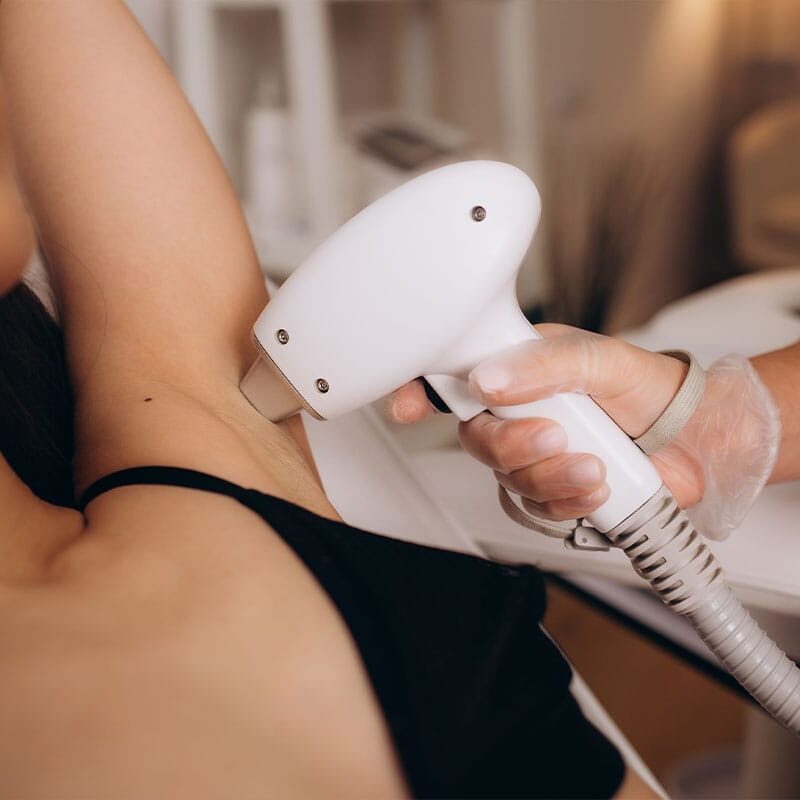 woman getting laser hair removal in Clermont, FL