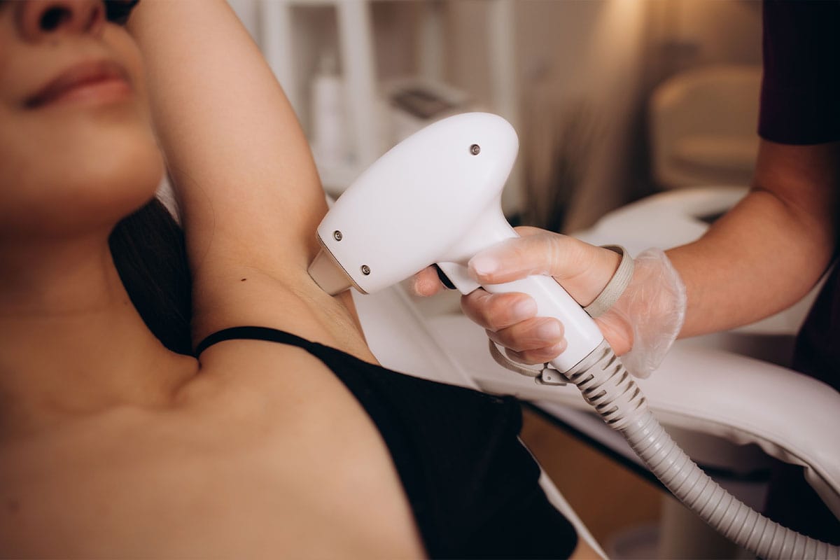 woman getting laser hair removal in Clermont, FL